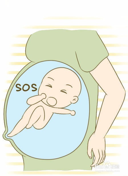 几个胎儿宫内缺氧信号记牢!