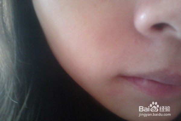 如何用PS去除脸上的痘痘