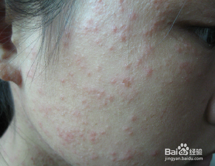 不同人群的便秘问题形成原因以及应该如何缓解