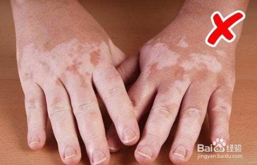 如何通过皮肤症状判断身体健康情况