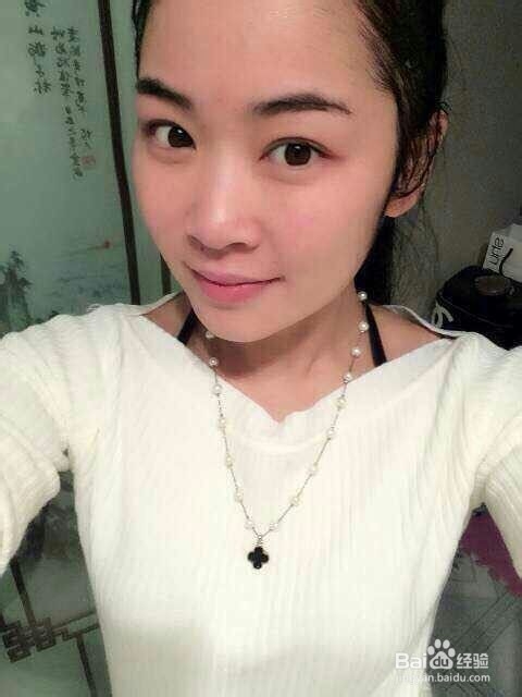 怎样快速修复过敏