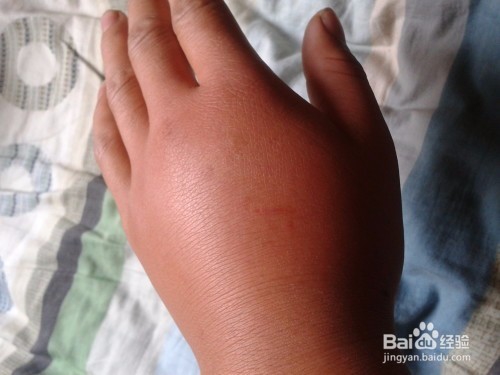 遇到马蜂或者马蜂窝怎么办