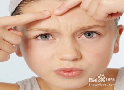 脸上总是长痘痘的四个因素