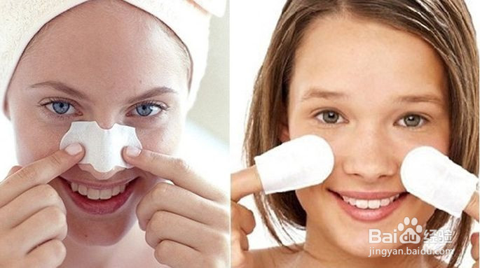 如何去除脸上的黑头？