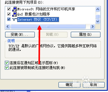 本地连接怎么自动获取IP