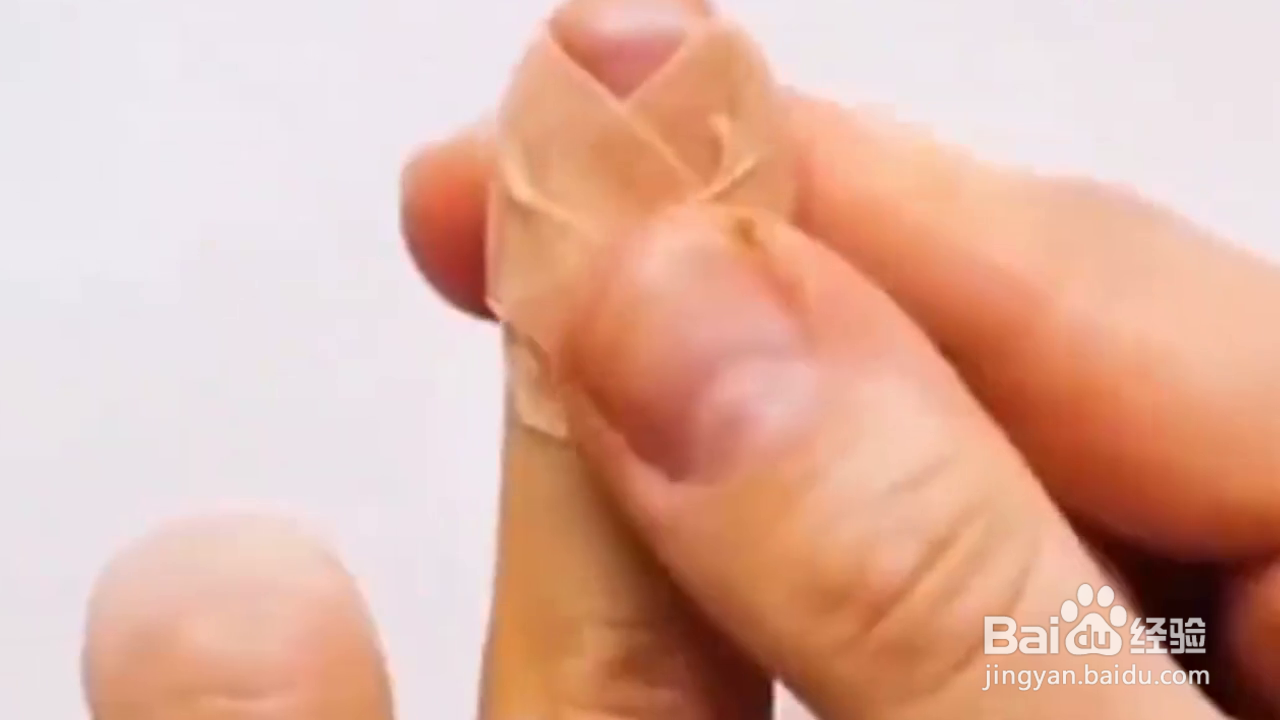 如何掌握处理伤口小技巧