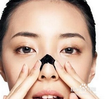 日常肌肤护理：[2]去除脸上黑头