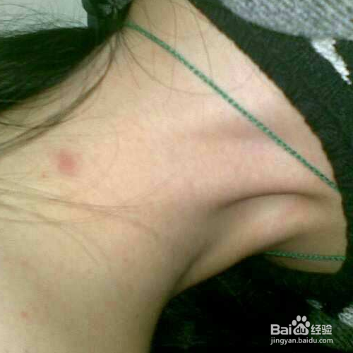 怎样用化妆做假吻痕 ?