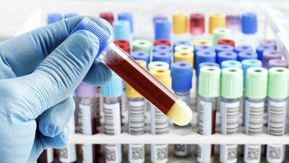 喝水对验血有什么影响