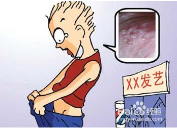 尖锐湿尤是怎么感染的啊