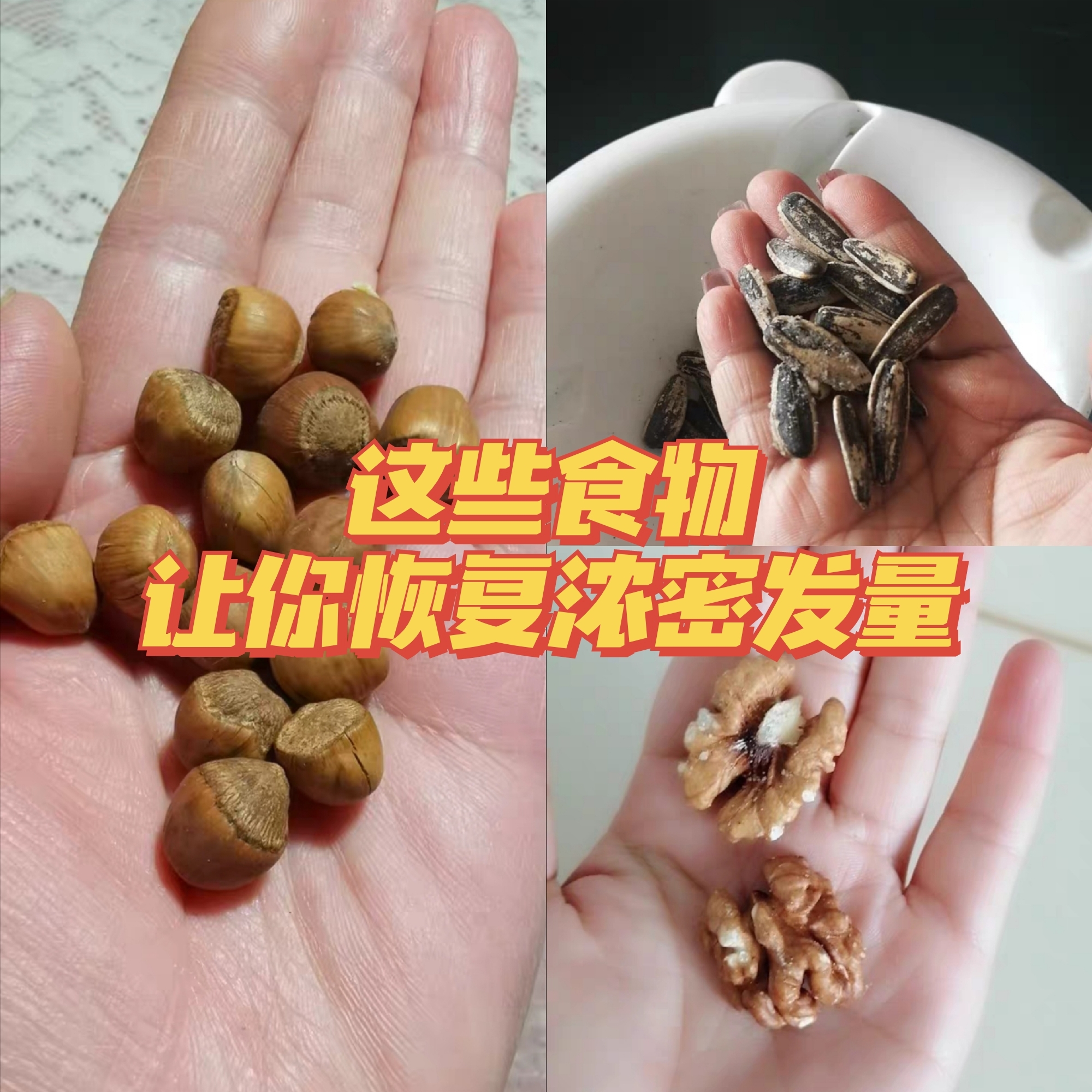掉发严重怎么办这些食材帮你迅速恢复浓密发量