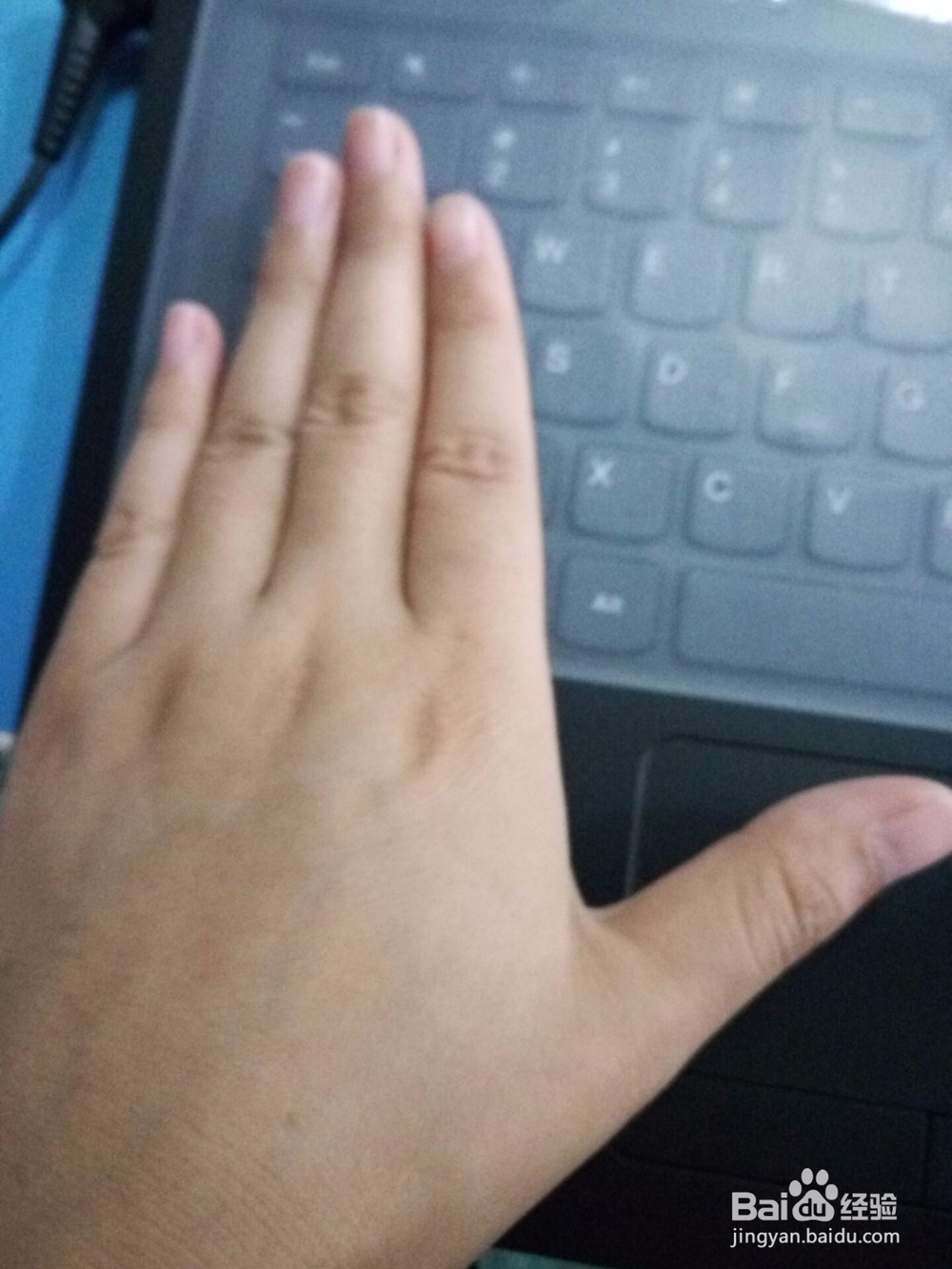 青年和青少年腰部日常保养与护理