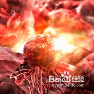 个人卫生方面如何预防阴道炎