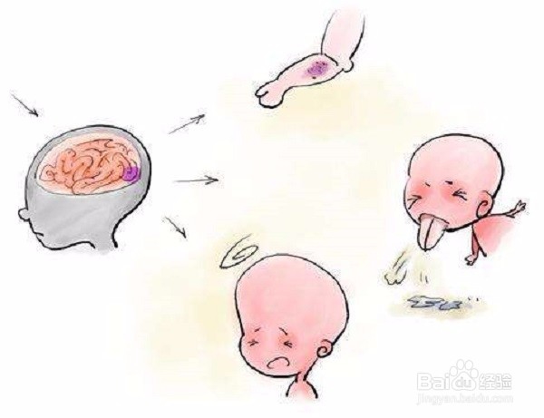 昏迷可能是什么病？