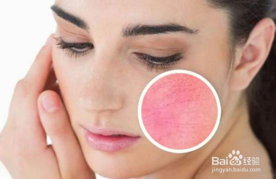 不知道相宜本草和百雀羚哪个补水保湿好一些