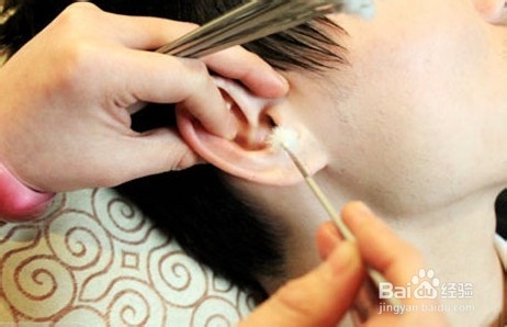 减肥常识：[2]中医三管齐下让你轻松瘦身