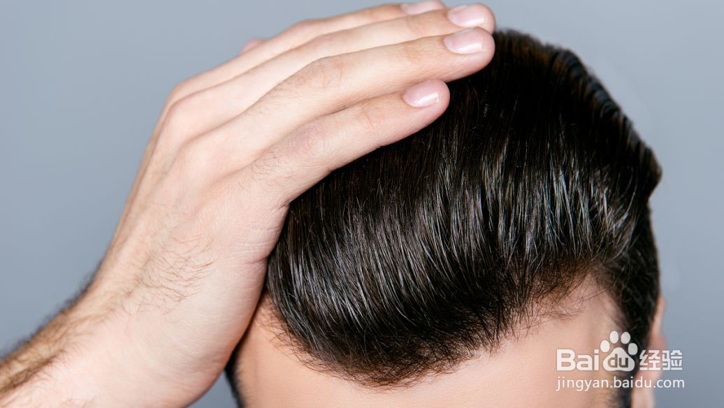 硫磺皂洗头的作用与功效