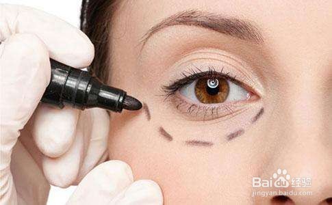 眼袋怎样去除好