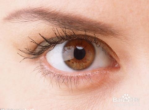 眼屎多是怎么回事