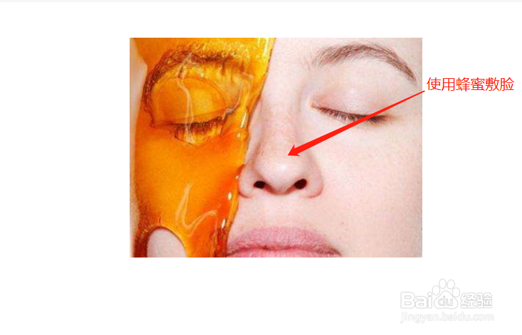 怎么去除脸上的痘印