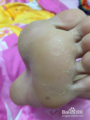 若有这4个“信号”，说明肝脏不太好