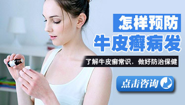 牛皮癣要怎么预防好呢
