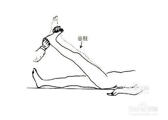 关节置换后怎样康复锻炼