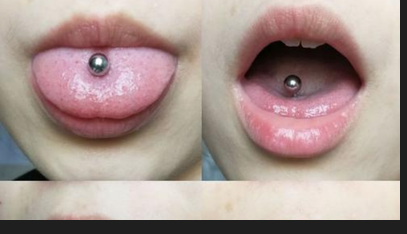 买回来的舌钉要消毒吗