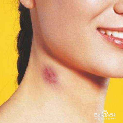 怎样用化妆做假吻痕 ?