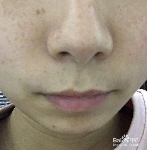 脸上容易长斑是由坏习惯引起的吗