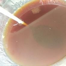 感冒如何不用药物治疗