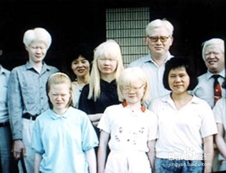 如何巧记高中生物教材中几种常见遗传病