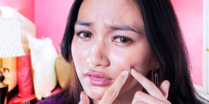 挤痘痘的危害与去痘的有效方法