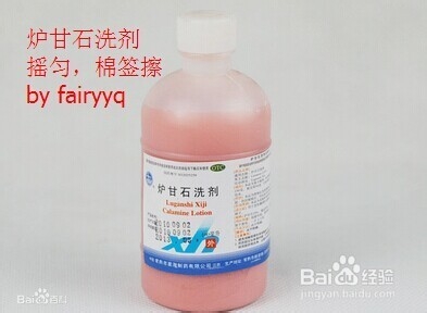 宝宝成长集：[2]宝宝抓伤脸的防治