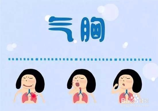 这20个生活中的急救常识 , 很重要,你知道吗