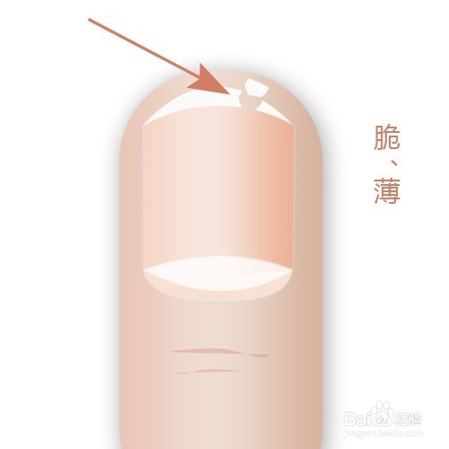 通过指甲看身体状况