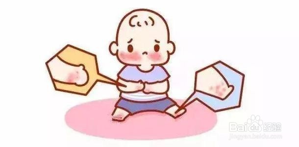 手足口病如何预防和应对