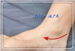 如何消除腿部水肿