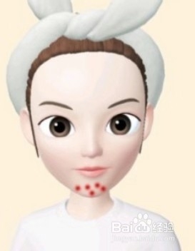 脸上长痘的原因和治疗方法你学会了吗