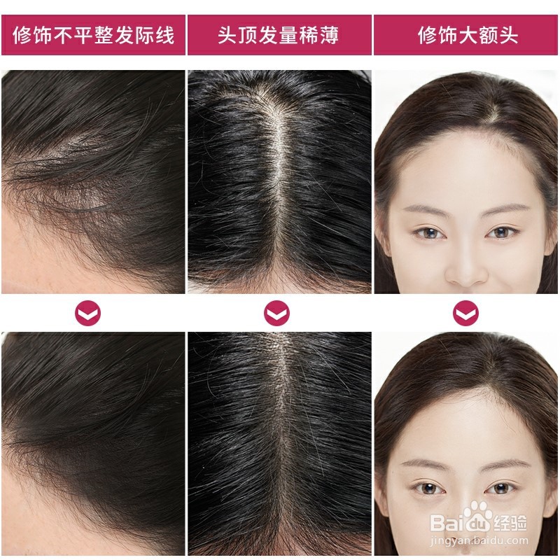 发际线高怎么办