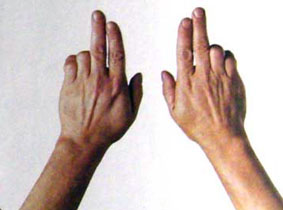 弹筝者怎样锻炼手指的灵活度