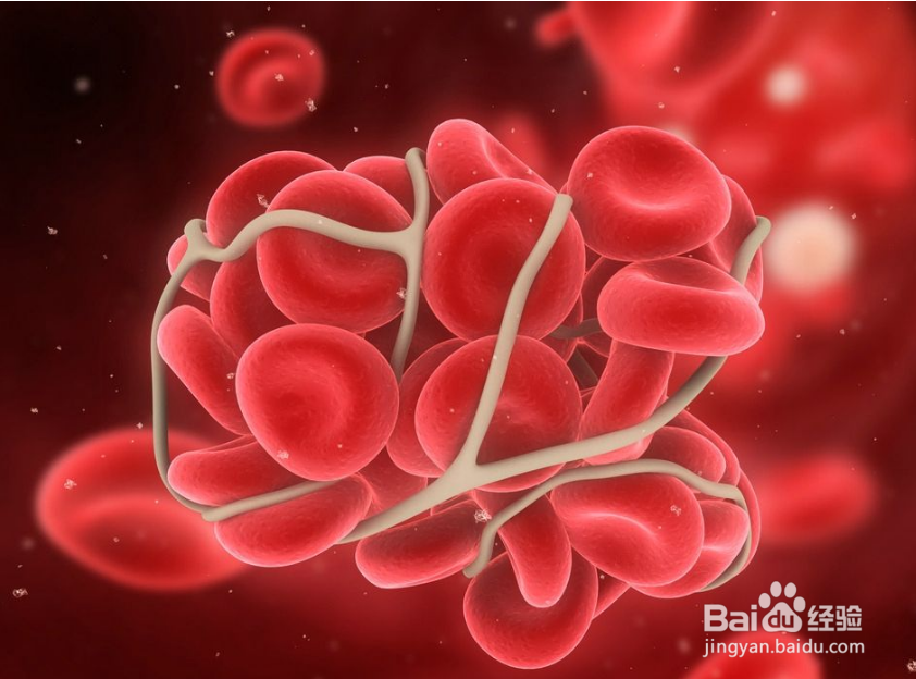 女性尖锐湿尤为什么不易被发现