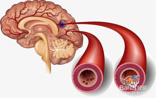舒健宁脑栓通胶囊（华南）能长期吃吗