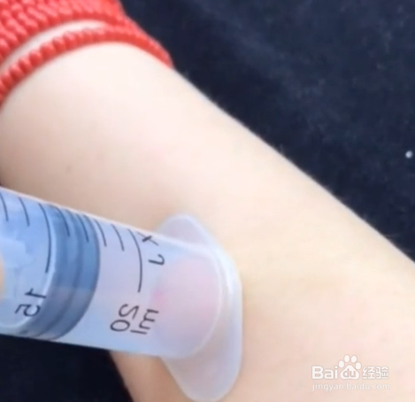 注射器的小妙招