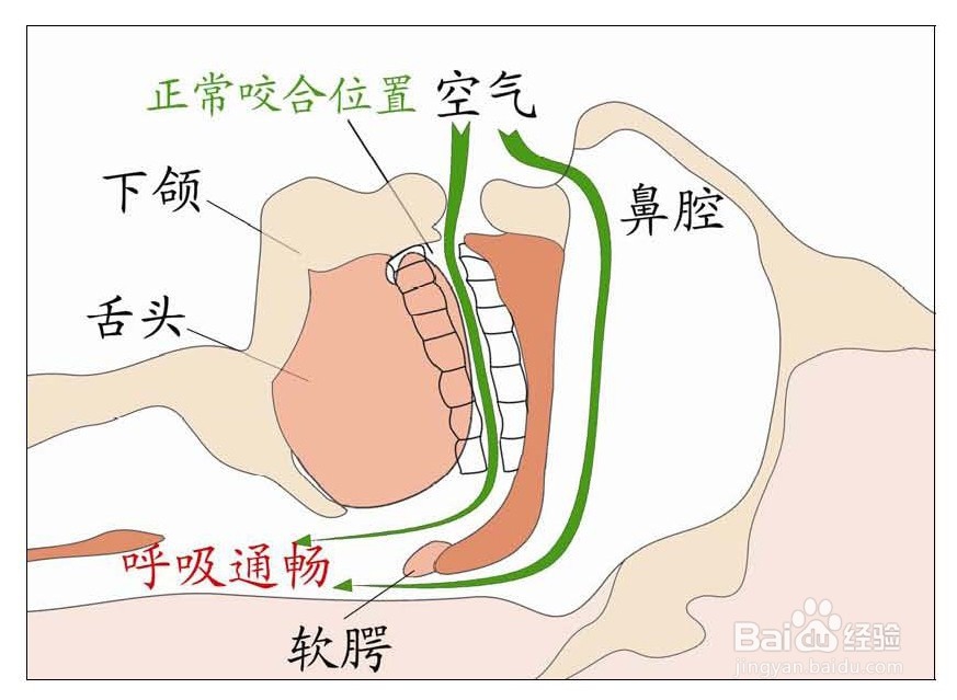 打呼噜怎么办，打鼾声怎么治疗看看我的经验