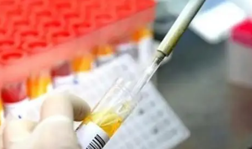 十人混检手机能查到不