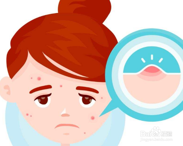 如何用天然的方法祛痘