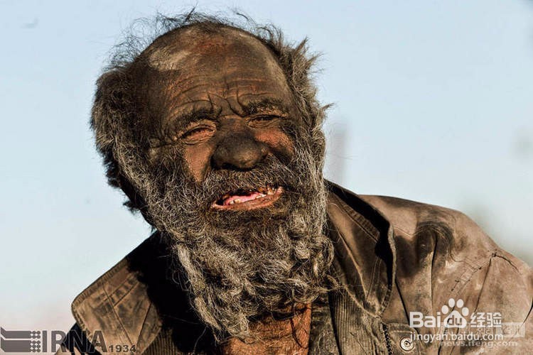 夏天身体有异味怎么办？