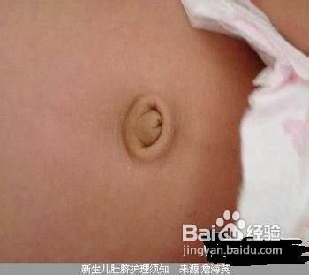 新生儿的脐带应该怎么护理呢