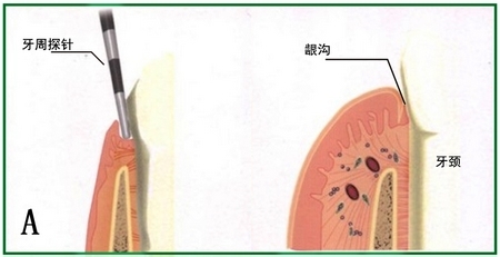 牙龈出血，并不是补充维生素就可以的